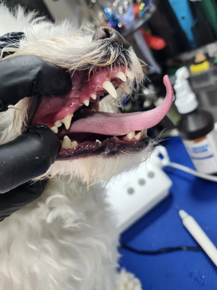 Dental hygiene after result